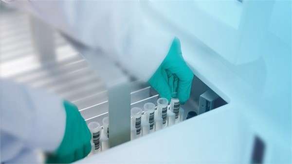单分子免疫检测技术：肿瘤诊疗的“超级放大镜”